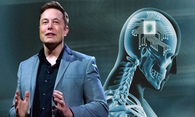 Elon Musk thành công xin cấp phép công nghệ cấy chip não ở người