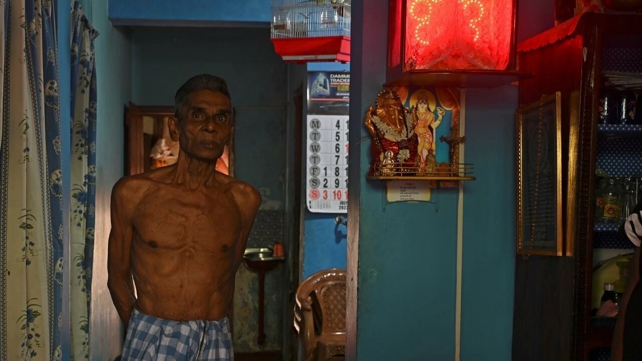 Sri Lanka: Nạn đói lan rộng trên đảo Slave Sri Lanka: Nạn đói lan rộng trên đảo Slave