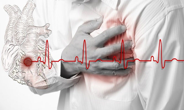 Nguyên nhân gây bệnh và dấu hiệu cảnh báo bệnh nhồi máu cơ tim