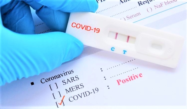 16 loại test nhanh kháng nguyên SARS-CoV-2 được Bộ Y tế cấp phép