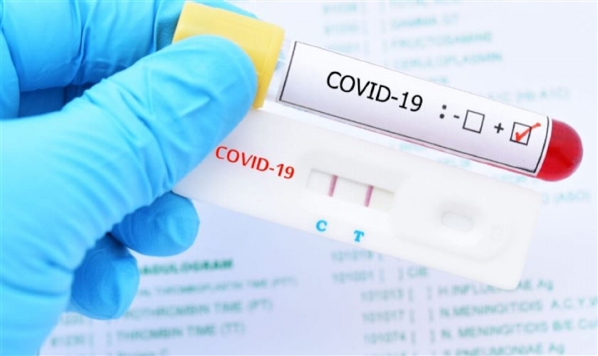 Sản phẩm test nhanh Covid-19