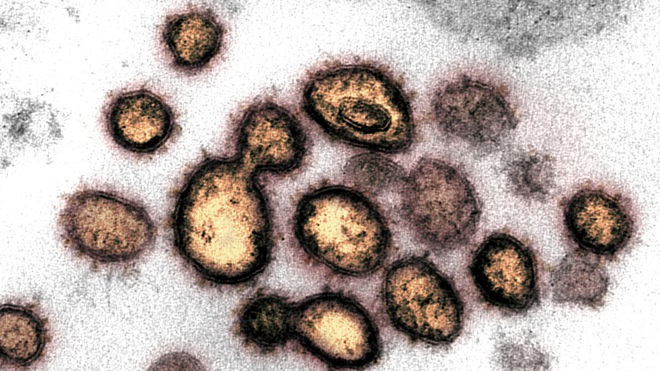 Nguy cơ xuất hiện biến chủng mới lây lan hơn Delta, chết chóc hơn Ebola - 1